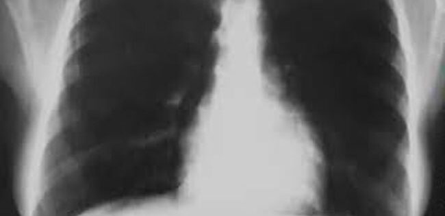 La Métamorphose d'Agnès Sorel